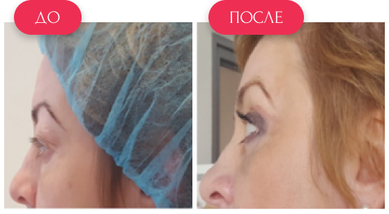  — до и после