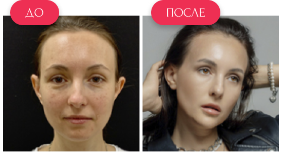  — до и после