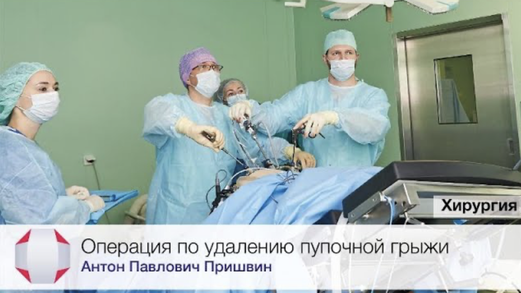 Операция по удалению пупочной грыжи