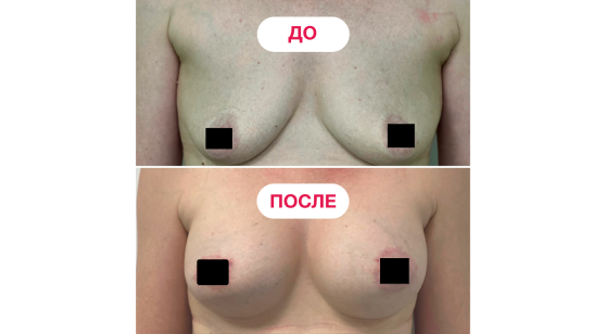  — до и после