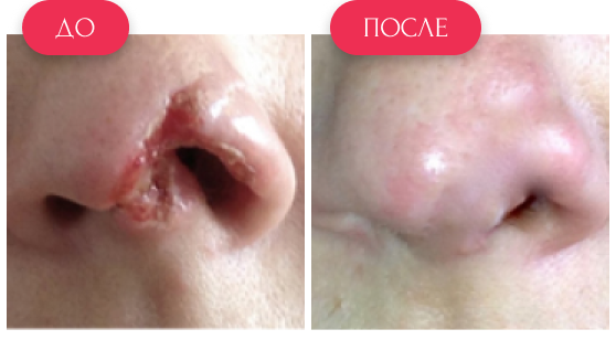  — до и после