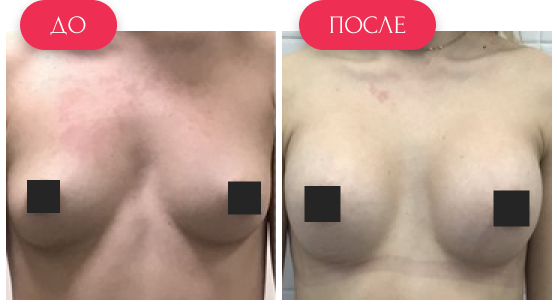  — до и после
