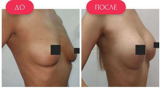  — до и после