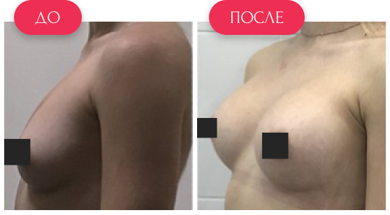  — до и после