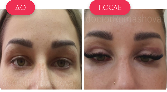  — до и после
