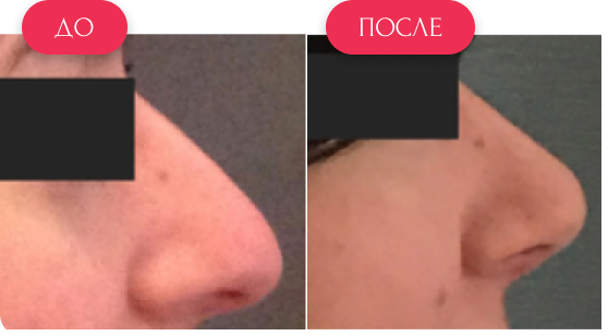  — до и после