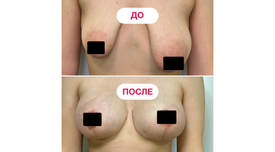  — до и после