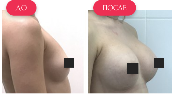  — до и после