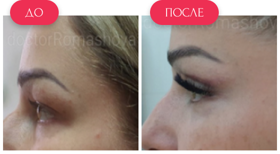  — до и после