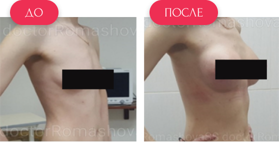  — до и после